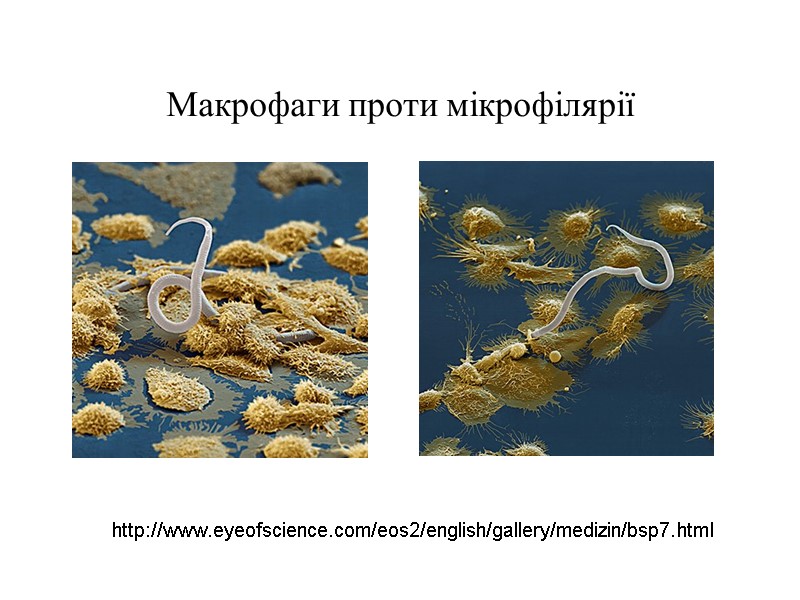 Макрофаги проти мікрофілярії http://www.eyeofscience.com/eos2/english/gallery/medizin/bsp7.html